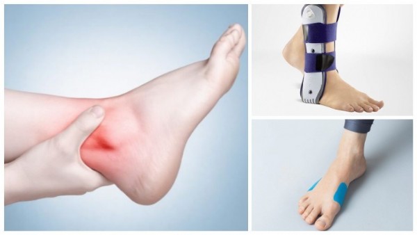 Ayak Bileği Şişmesi Neden Olur?